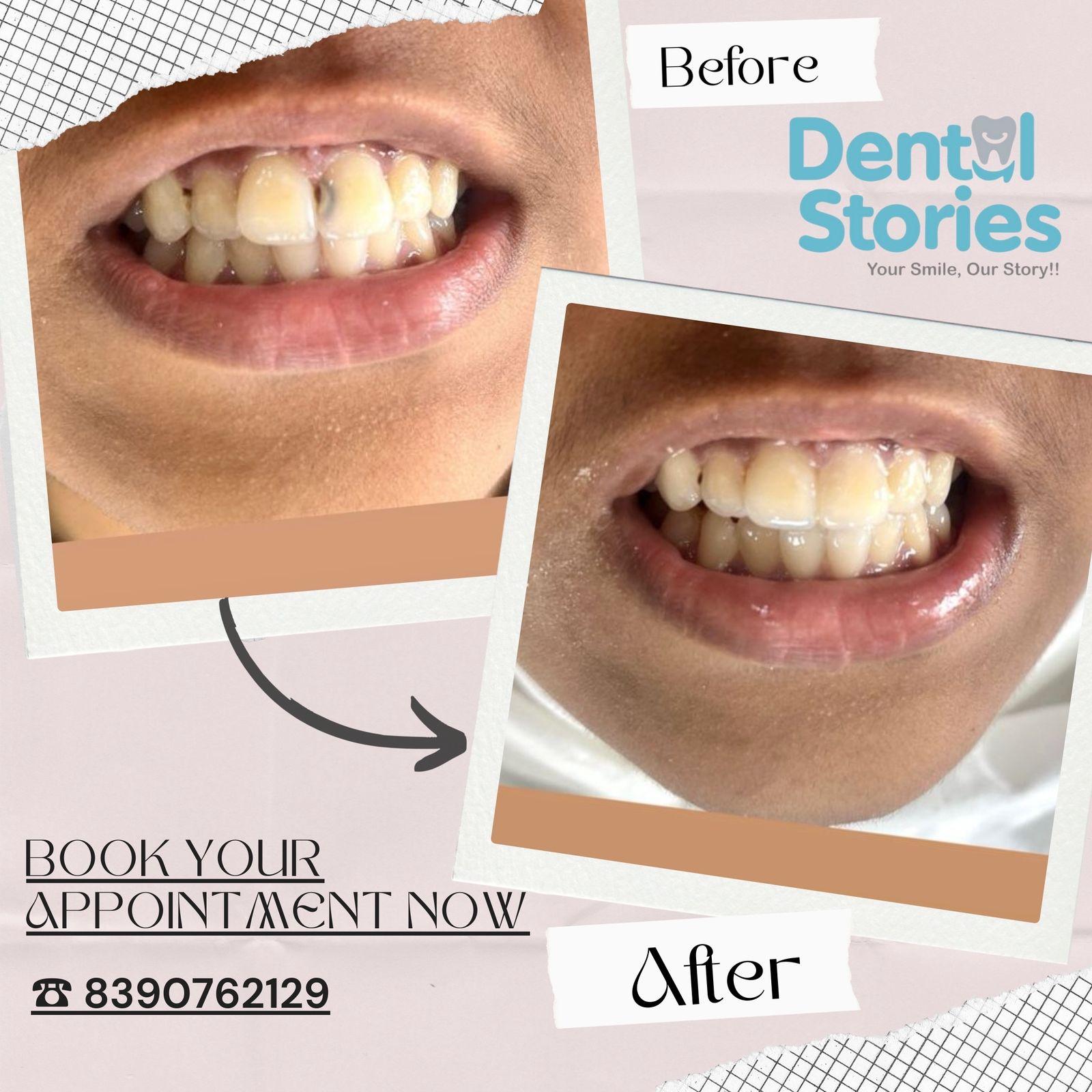 Before and after dental treatment